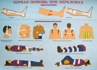 Что лучше при переломе