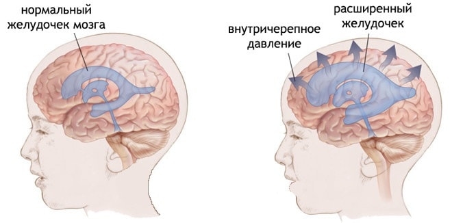 в чем измеряется вчд. Смотреть фото в чем измеряется вчд. Смотреть картинку в чем измеряется вчд. Картинка про в чем измеряется вчд. Фото в чем измеряется вчд